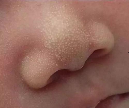 吃小白瓜舌头刺痛,小白瓜引发舌头刺痛之谜